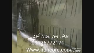 کاشت بولت 09125772171