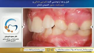 دکتر داودیان | متخصص ارتودنسی