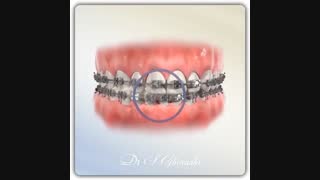 Elastics | dr.saeed ghorashi