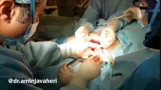 جراحی تعویض کامل مفصل لگن توسط دکتر علیرضا امین جواهری