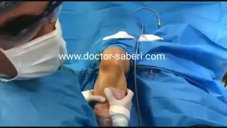 شلی مفصل زانو