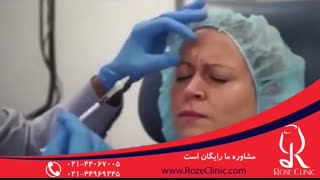 تزریق بوتاکس | فیلم تزریق بوتاکس | کلینیک پوست و مو رز 5