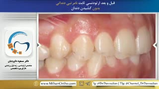 دکتر ارتودنسی در تهران