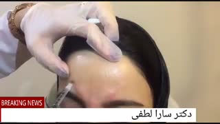 تزریق بوتاکس کشیدن دندان