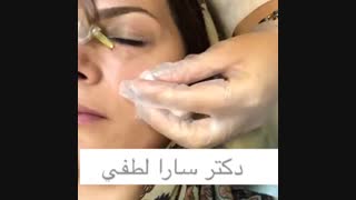 کربوکسی تراپی دندانپزشک زیبایی