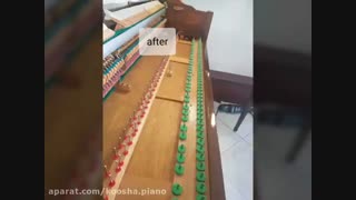 کوک پیانو با دستگاه جدید (کوشا ۰۹۱۲۵۶۳۳۸۹۵) تزریق بوتاکس