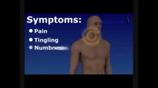 جراحی دیسک گردن با لیزر و بدون بیهوشی و برش جراحی