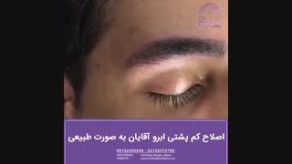 میکرواسکالپ ابرو