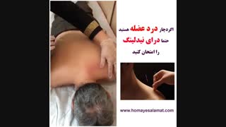 درای نیدلینگ