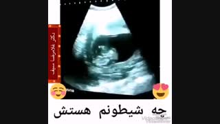 سونوگرافی جنین