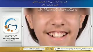 ارتودنسی غرب تهران | دکتر داوودیان