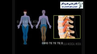 درمان دردهای انتشاری به پاها ناشی از دیسک کمر باکمک بلوک عصبی و بدون برش جراحی