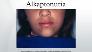 بیماری ادرار سیاه یا آلکاپتونوری و درمان آن