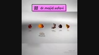 انواع سنگ های کلیه