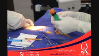 تزریق چربی | فیلم تزریق چربی | کلینیک پوست و مو رز | شماره14