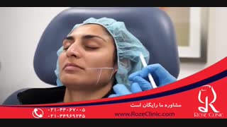 تزریق بوتاکس | فیلم تزریق بوتاکس | کلینیک پوست و مو رز8