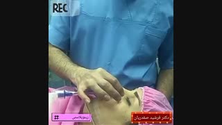 جراحی زیبایی بینی