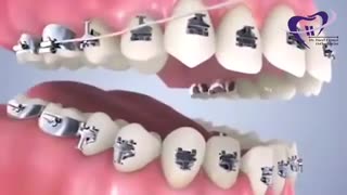 ارتودنسی دو فک | دکتر فیروزی