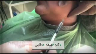 مزوتراپی غبغب تزریق بوتاکس