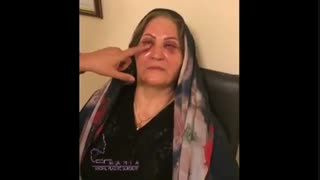 تزریق چربی به صورت