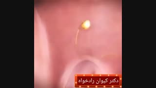 اندام تناسلی مردان در هفته هشتم بارداری