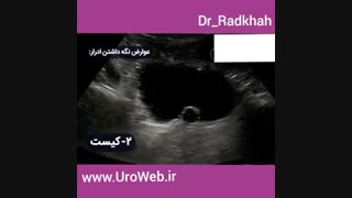 عوارض نگه داشتن ادرار