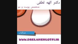 دانستنیهای لازم درباره ضدآفتاب پارت 2 اکستنشن تاج دندان