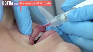 جدید ترین آموزش تتوی صورت- لب و ابرو