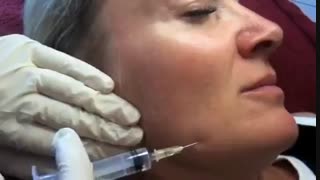 مزوتراپی صورت جراحی گوش