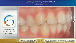 ارتودونسی شرق تهران | دکتر داوودیان