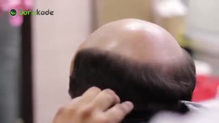 ریزش مو در مردان ( قسمت اول )