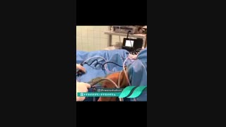 بازسازی رباط صلیبی با آرتروسکوپ