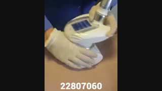 LPG - کلینیک زیبایی پری سیما - 22807060