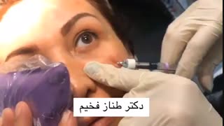 تزریق ژل زیر چشم