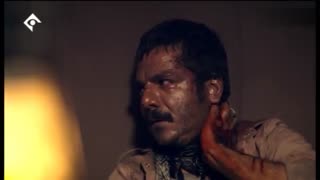 سریال مینو - 18 - Minoo کاشت مو