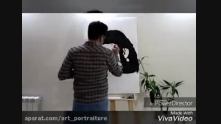 ناصر عبداللهی رفع غبغب