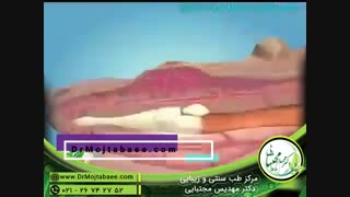 زگیل چگونه جایگزین می شود؟ | طب سنتی