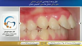 ارتودنسی غرب تهران | دکتر داوودیان