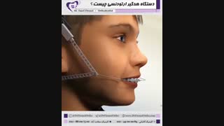 هد گیر در ارتودنسی | دکتر فاضل فیروزی