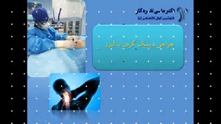 جراحی دیسک گردن با لیزر و بدون بیهوشی