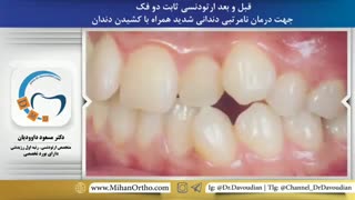 بهترین متخصص ارتودنسی | دکتر داوودیان