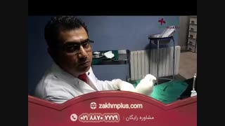 درمان زخم پای دیابتی