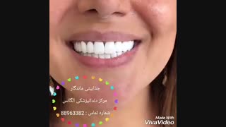 بهترین دندانپزشکی مرکز تهران | بهترین دندانپزشکی  در تهران | بهترین دندانپزشکی غرب تهران | بهترین متخصص لمینیت در تهران