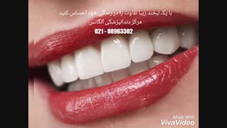 بهترین دندانپزشکی زیبایی در مرکز تهران | بهترین دندانپزشک زیبایی غرب تهران | بهترین دندانپزشک زیبایی و ترمیمی در تهران