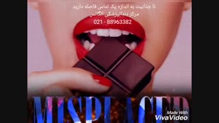 پروتز دندان | پروتز ثابت دندان |پروتز متحرک دندان | خدمات زیبایی دندان | انواع کامپوزیت های دندانی | فرق روکش دندان با کامپوزیت