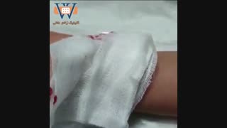 کلینیک درمان زخم هانی
