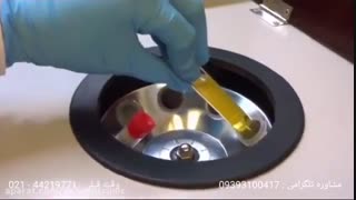 پی آر پی صورت لیزر مو