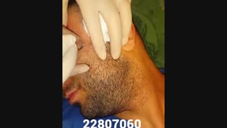 لیزر جوانسازی - کلینیک زیبایی پری سیما - 22807060 کلینیک پوست