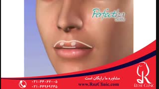 تزریق چربی | فیلم تزریق چربی | کلینیک پوست و مو رز | شماره18