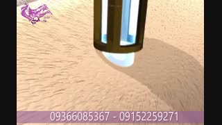 رفع موهاى زائد